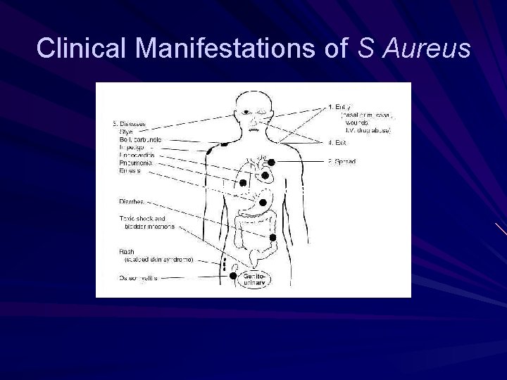 Clinical Manifestations of S Aureus 