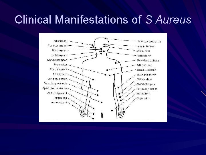 Clinical Manifestations of S Aureus 