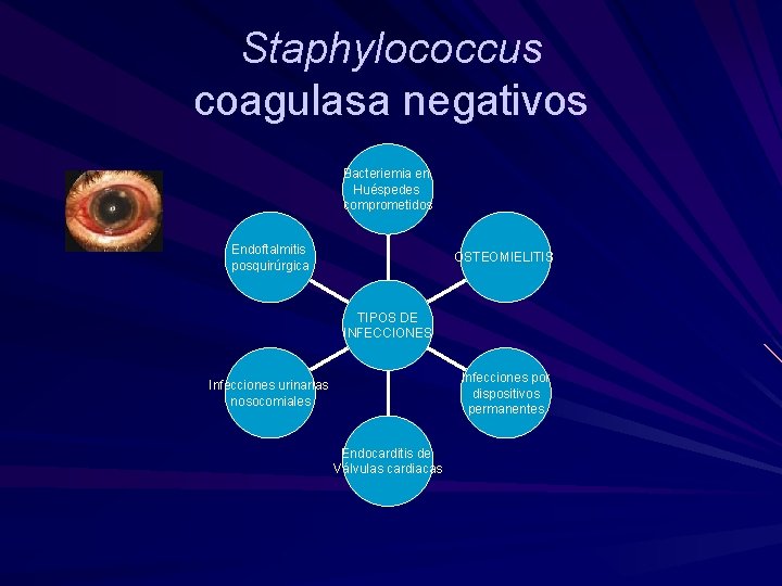 Staphylococcus coagulasa negativos Bacteriemia en Huéspedes comprometidos Endoftalmitis posquirúrgica OSTEOMIELITIS TIPOS DE INFECCIONES Infecciones