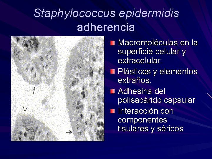 Staphylococcus epidermidis adherencia Macromoléculas en la superficie celular y extracelular. Plásticos y elementos extraños.