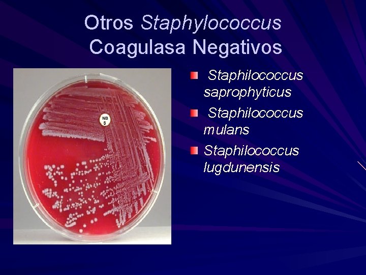 Otros Staphylococcus Coagulasa Negativos Staphilococcus saprophyticus Staphilococcus mulans Staphilococcus lugdunensis 