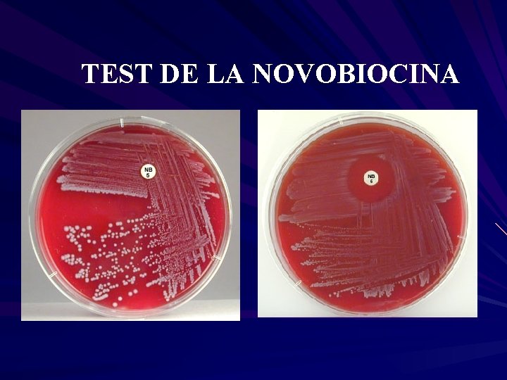 TEST DE LA NOVOBIOCINA 