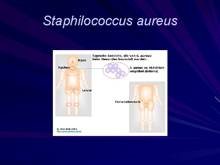Staphilococcus aureus 