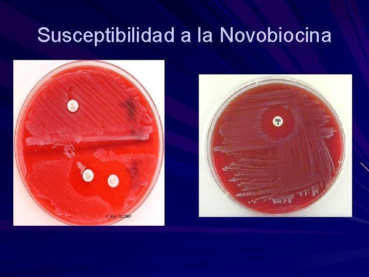 Susceptibilidad a la Novobiocina 