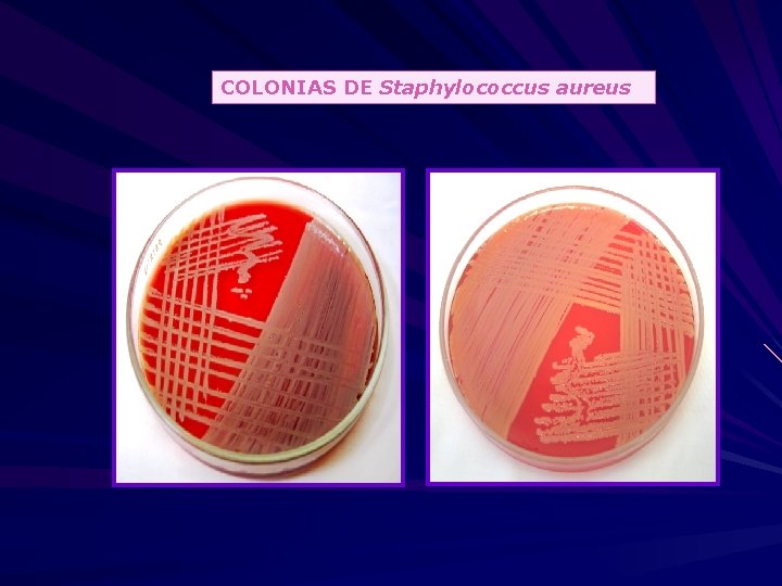 COLONIAS DE Staphylococcus aureus 