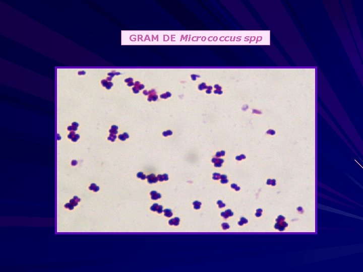 GRAM DE Micrococcus spp 