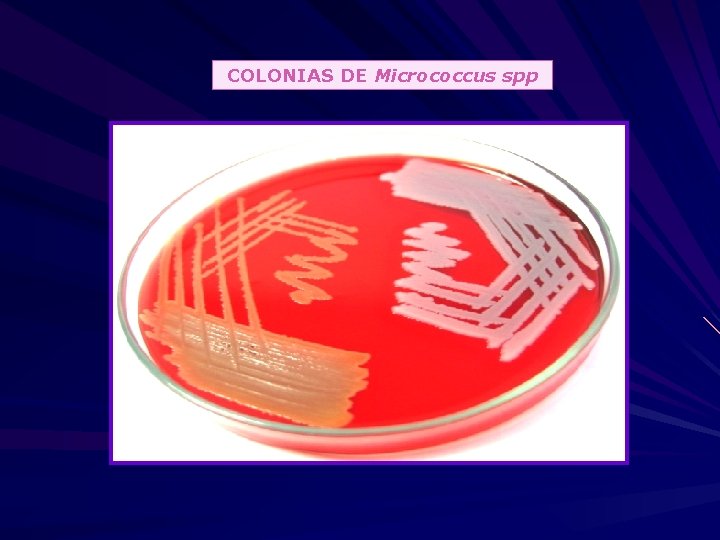 COLONIAS DE Micrococcus spp 