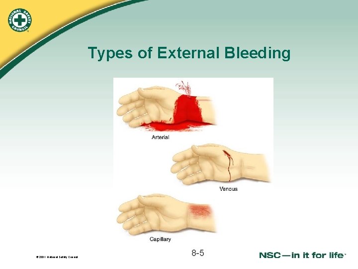 Types of External Bleeding © 2011 National Safety Council 8 -5 Types of External Bleeding © 2011 National Safety Council 8 -5