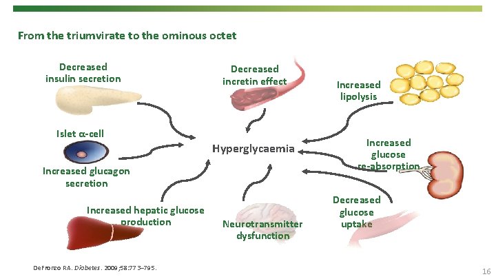 From the triumvirate to the ominous octet Decreased insulin secretion Islet α-cell Decreased incretin