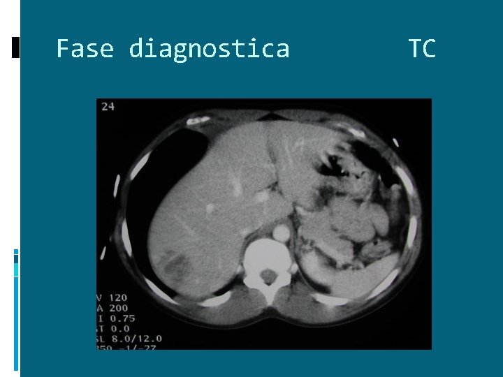 Fase diagnostica TC 