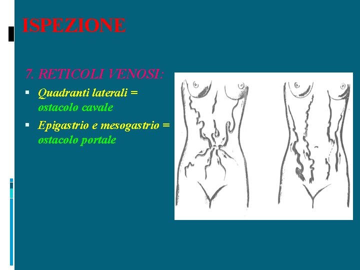 ISPEZIONE 7. RETICOLI VENOSI: Quadranti laterali = ostacolo cavale Epigastrio e mesogastrio = ostacolo
