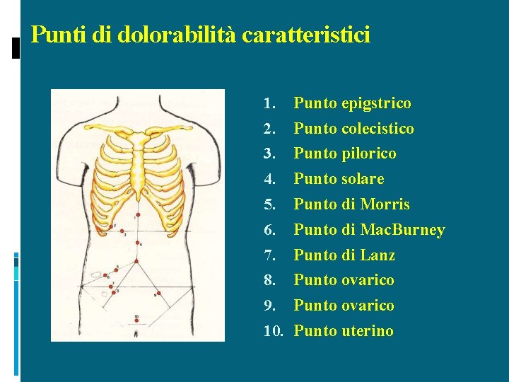 Punti di dolorabilità caratteristici Punto epigstrico 2. Punto colecistico 3. Punto pilorico 4. Punto