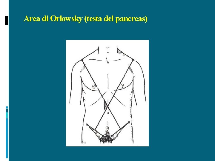 Area di Orlowsky (testa del pancreas) 