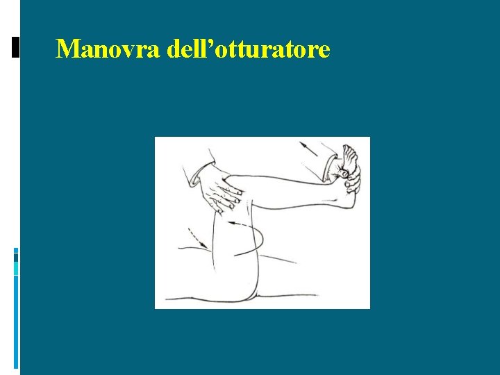 Manovra dell’otturatore 