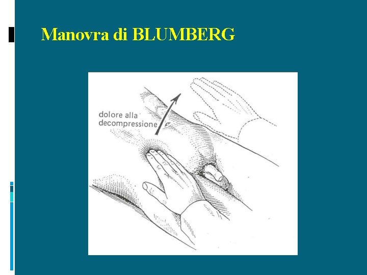 Manovra di BLUMBERG 