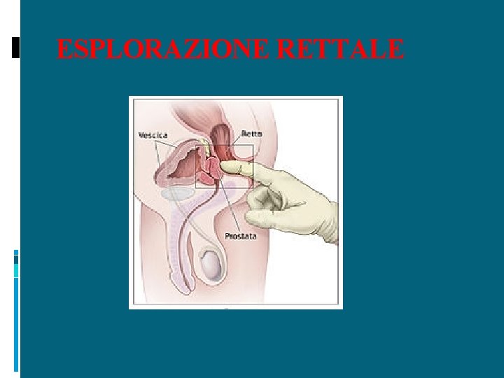 ESPLORAZIONE RETTALE 