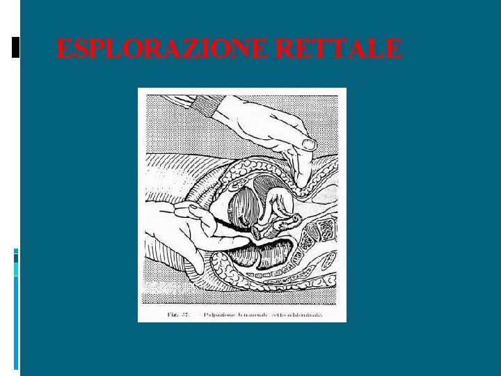 ESPLORAZIONE RETTALE 