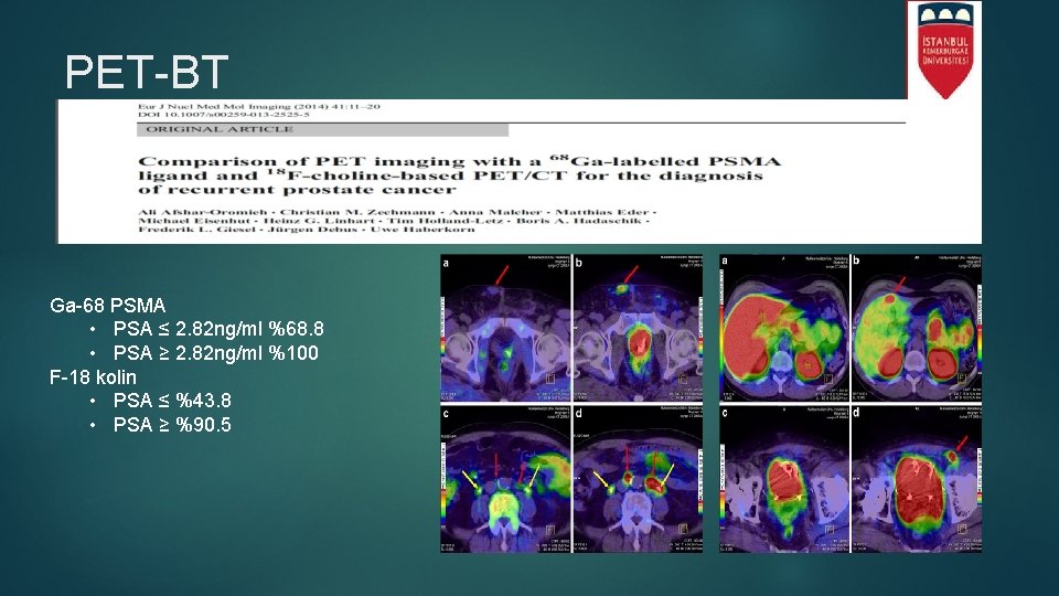 PET-BT Ga-68 PSMA • PSA ≤ 2. 82 ng/ml %68. 8 • PSA ≥