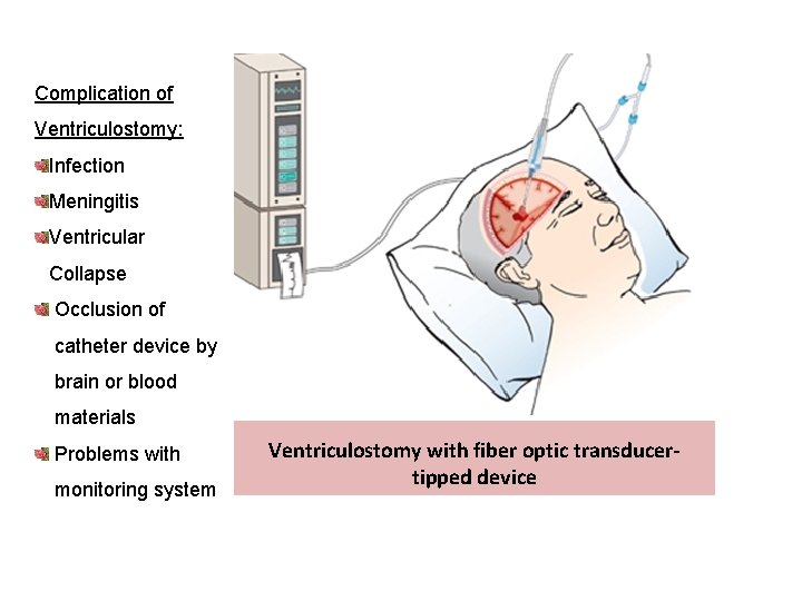 Complication of Ventriculostomy: Infection Meningitis Ventricular Collapse Occlusion of catheter device by brain or