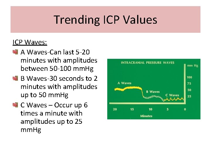 Trending ICP Values ICP Waves: A Waves-Can last 5 -20 minutes with amplitudes between