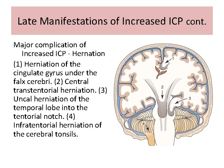 Late Manifestations of Increased ICP cont. Major complication of Increased ICP - Hernation (1)