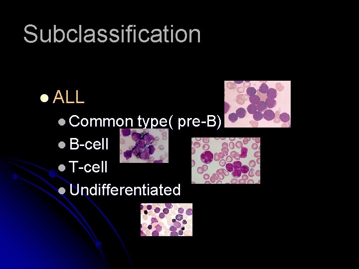 Subclassification l ALL l Common type( pre-B) l B-cell l T-cell l Undifferentiated 