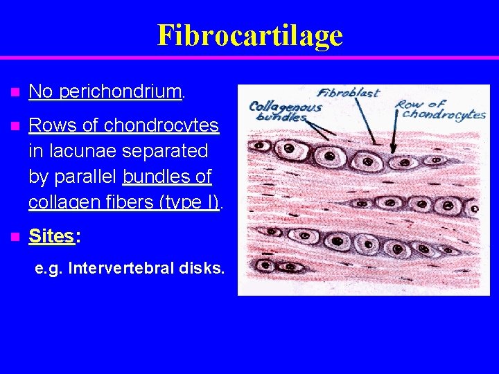 Fibrocartilage n No perichondrium. n Rows of chondrocytes in lacunae separated by parallel bundles