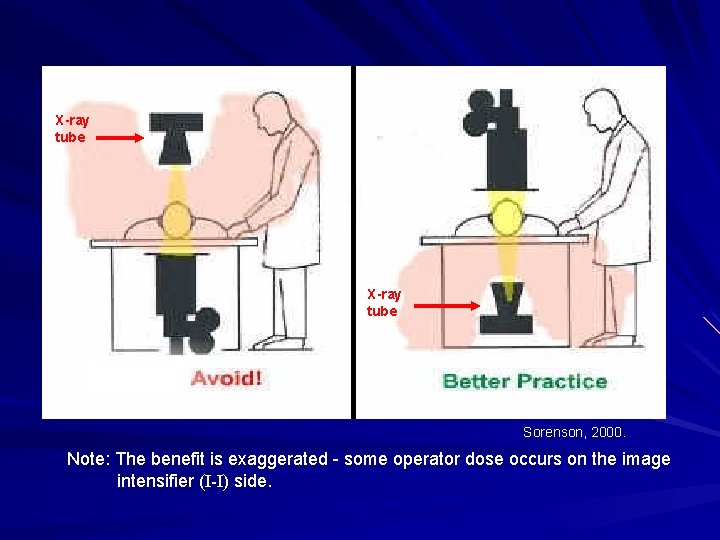 X-ray tube Sorenson, 2000. Note: The benefit is exaggerated - some operator dose occurs