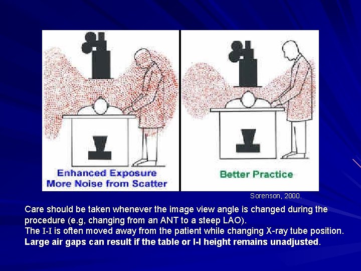 Sorenson, 2000. Care should be taken whenever the image view angle is changed during