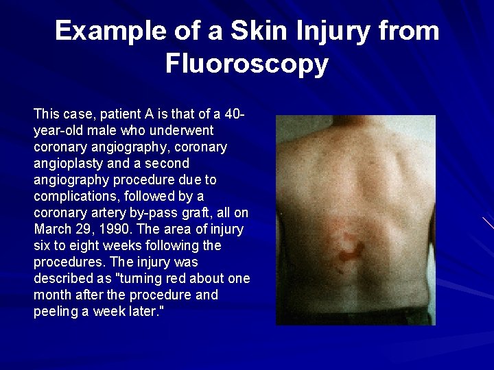 Example of a Skin Injury from Fluoroscopy This case, patient A is that of