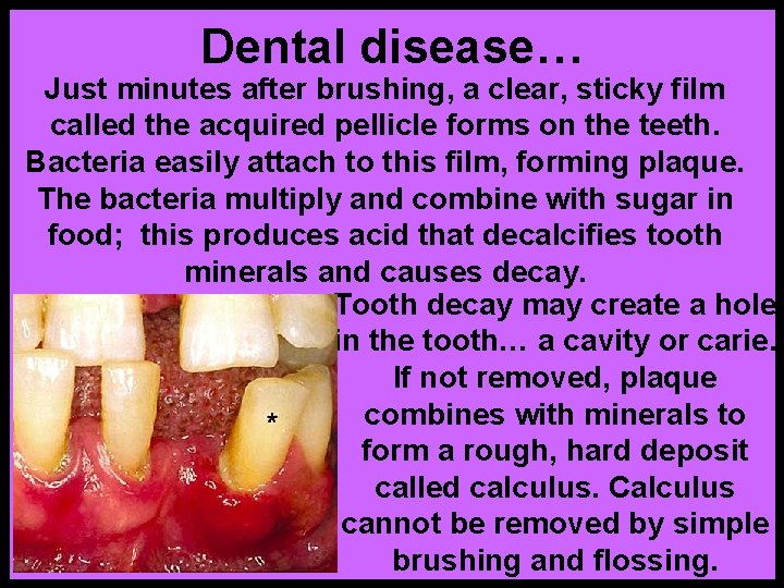 Dental disease… Just minutes after brushing, a clear, sticky film called the acquired pellicle