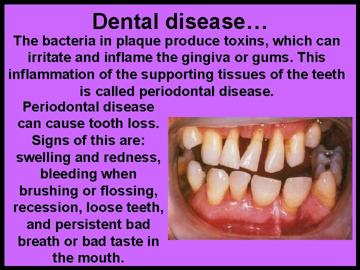 Dental disease… The bacteria in plaque produce toxins, which can irritate and inflame the