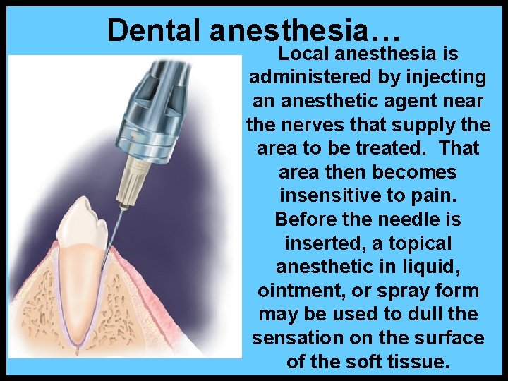 Dental anesthesia… Local anesthesia is administered by injecting an anesthetic agent near the nerves