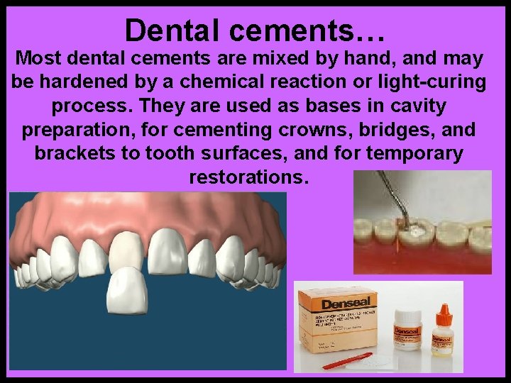 Dental cements… Most dental cements are mixed by hand, and may be hardened by