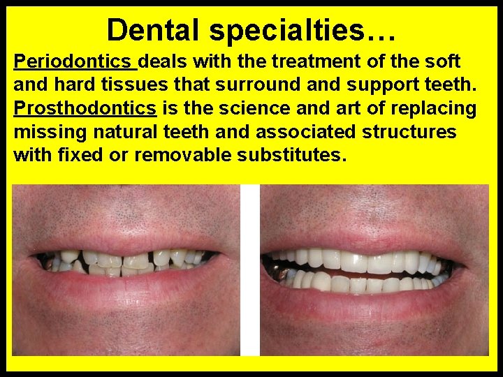 Dental specialties… Periodontics deals with the treatment of the soft and hard tissues that