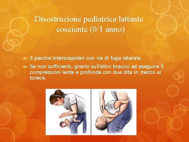 Disostruzione pediatrica lattante cosciente (0/1 anno) 5 pacche interscapolari con via di fuga laterale