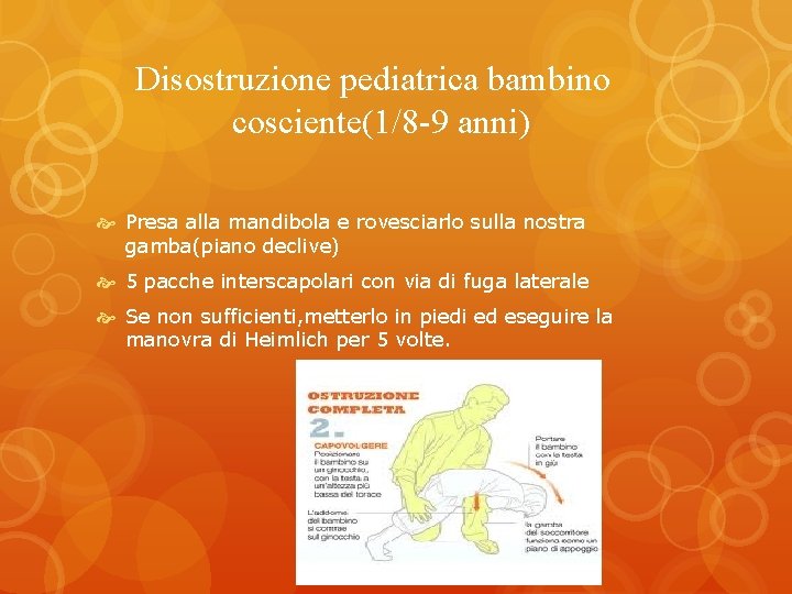 Disostruzione pediatrica bambino cosciente(1/8 -9 anni) Presa alla mandibola e rovesciarlo sulla nostra gamba(piano