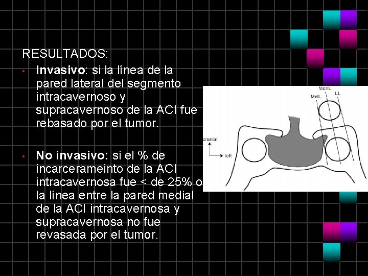 RESULTADOS: • Invasivo: si la línea de la pared lateral del segmento intracavernoso y