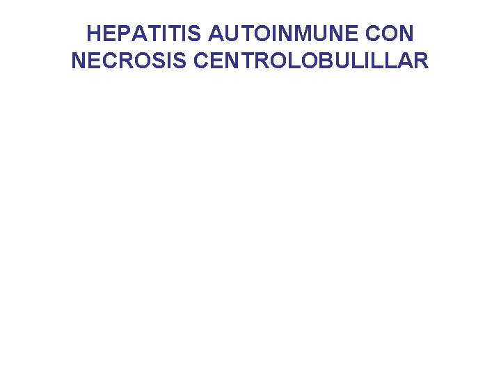 HEPATITIS AUTOINMUNE CON NECROSIS CENTROLOBULILLAR 