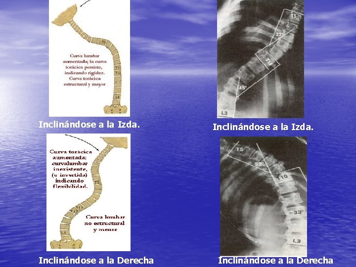 Inclinándose a la Izda. Inclinándose a la Derecha 