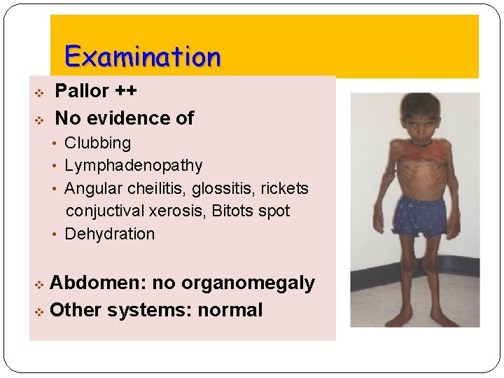 Examination v v Pallor ++ No evidence of • Clubbing • Lymphadenopathy • Angular