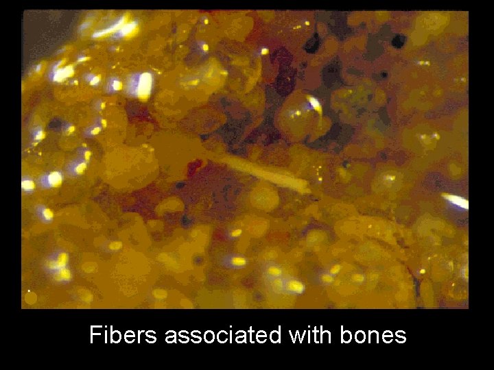 Fibers associated with bones 