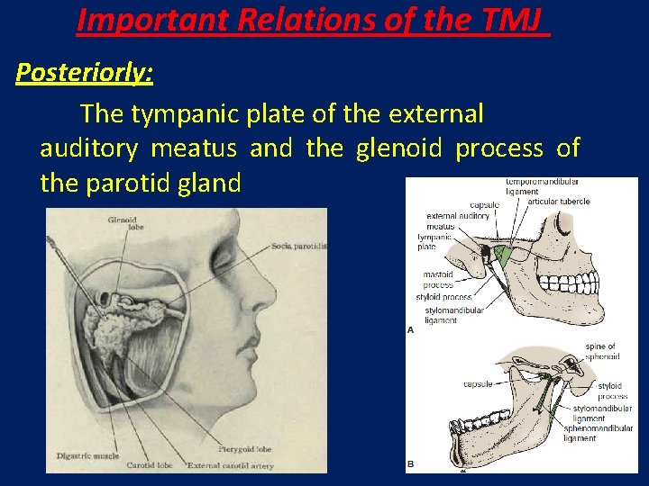 Important Relations of the TMJ Posteriorly: The tympanic plate of the external auditory meatus
