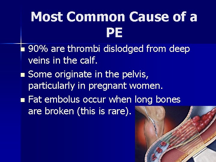 Most Common Cause of a PE 90% are thrombi dislodged from deep veins in