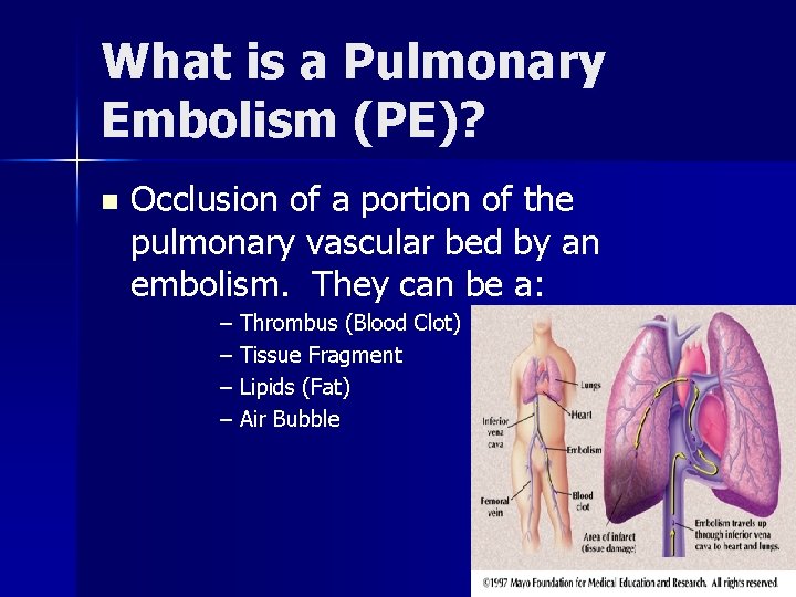 What is a Pulmonary Embolism (PE)? n Occlusion of a portion of the pulmonary