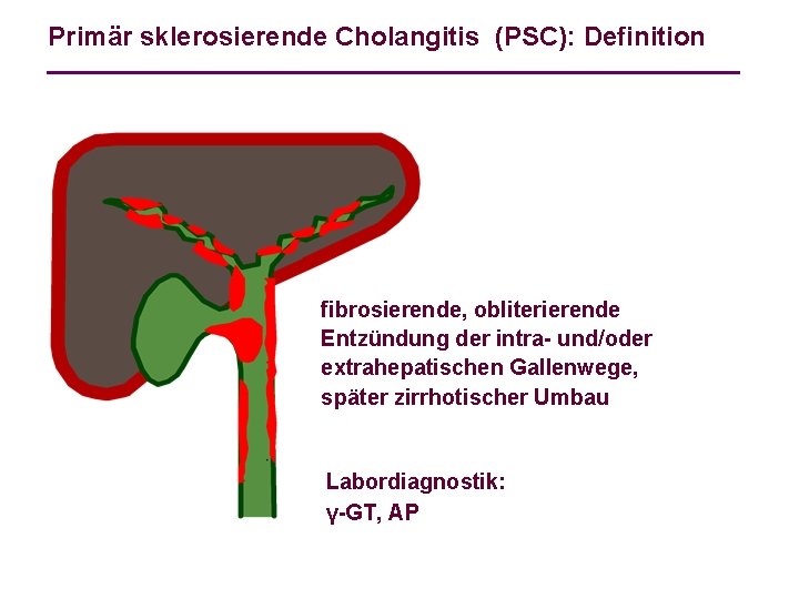 Primär sklerosierende Cholangitis (PSC): Definition fibrosierende, obliterierende Entzündung der intra- und/oder extrahepatischen Gallenwege, später