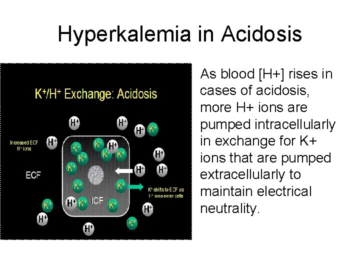 Hyperkalemia in Acidosis • As blood [H+] rises in cases of acidosis, more H+