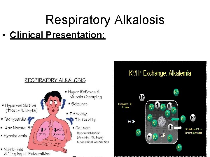 Respiratory Alkalosis • Clinical Presentation: 