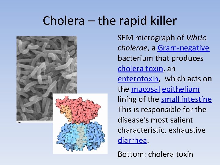 Cholera – the rapid killer SEM micrograph of Vibrio cholerae, a Gram-negative bacterium that