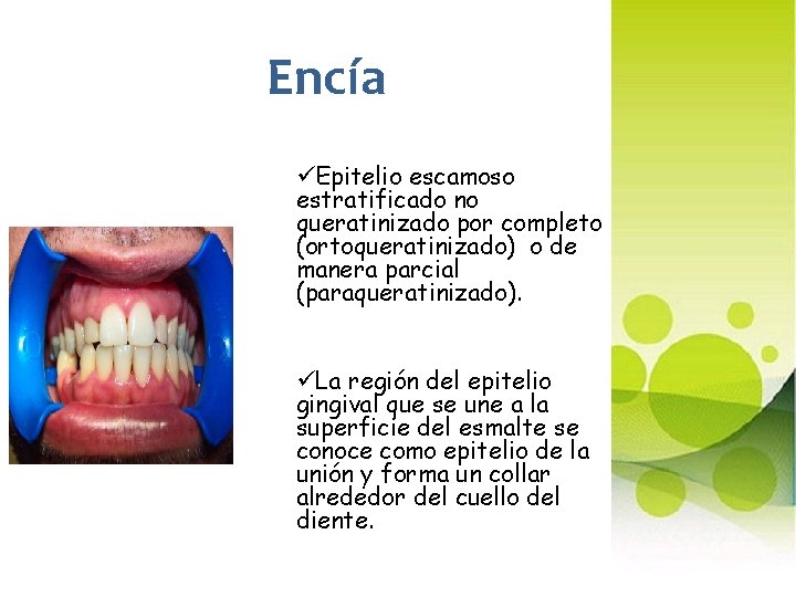 Encía üEpitelio escamoso estratificado no queratinizado por completo (ortoqueratinizado) o de manera parcial (paraqueratinizado).